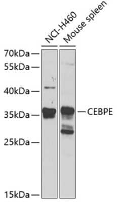 Western Blot: CEBP epsilon Antibody [NBP2-92530] - Western blot analysis of extracts of various cell lines, using CEBP epsilon antibody (NBP2-92530) at 1:1000 dilution. Secondary antibody: HRP Goat Anti-Rabbit IgG (H+L) at 1:10000 dilution. Lysates/proteins: 25ug per lane. Blocking buffer: 3% nonfat dry milk in TBST. Detection: ECL Basic Kit. Exposure time: 90s.